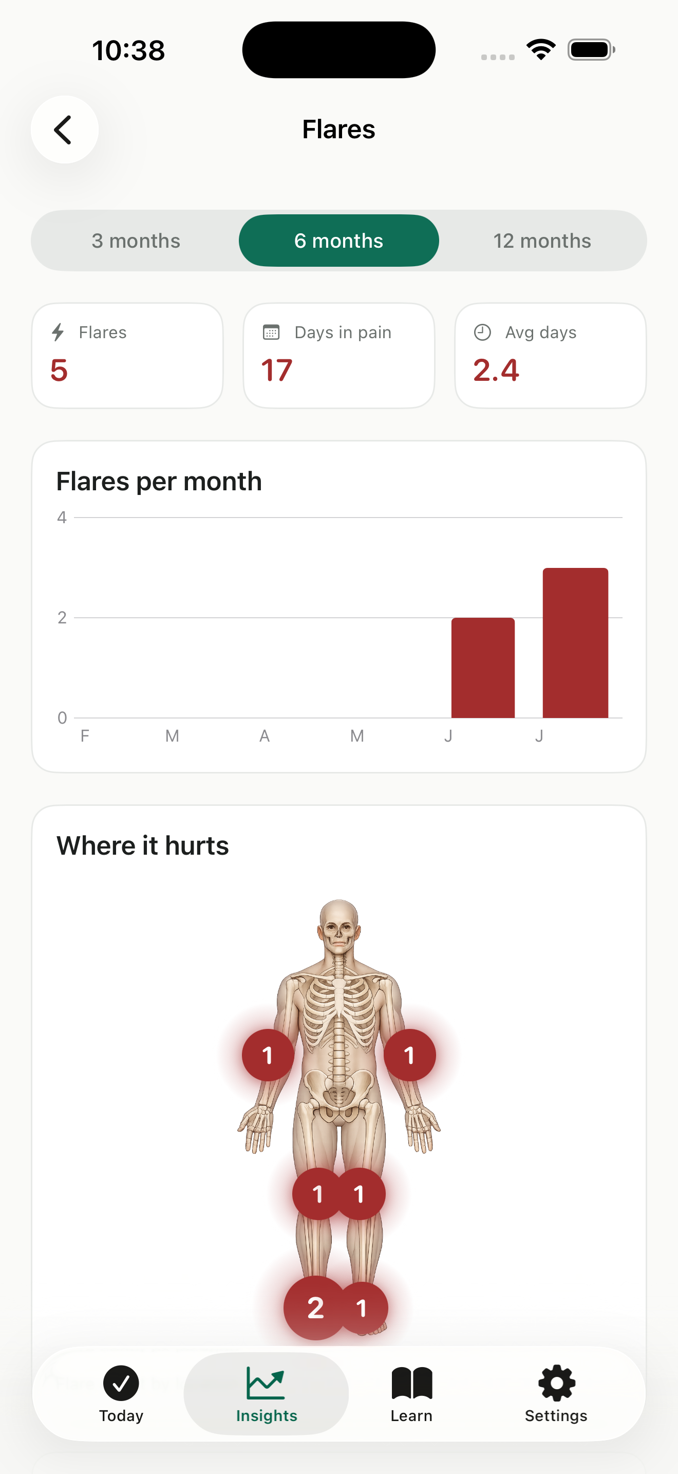 Goutly Flares: totals for flares, days in pain and average duration, a flares-per-month chart, and a Where it hurts body map with per-joint counts.